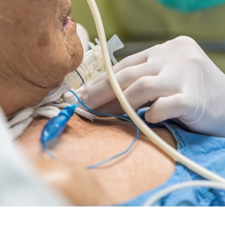 Tracheostomy